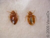 Bedbug Bite