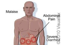 Foodborne/Waterborne Diseases