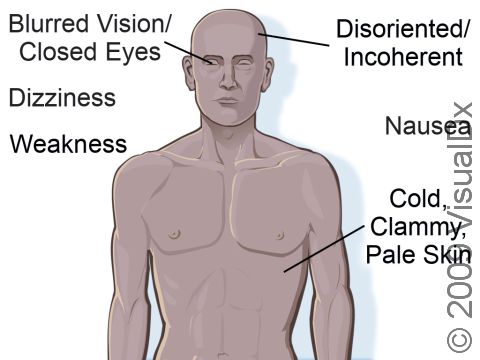 Fainting signs and symptoms can include dizziness; weakness; nausea; cold, pale, clammy skin; and/or blurred vision / closed eyes.