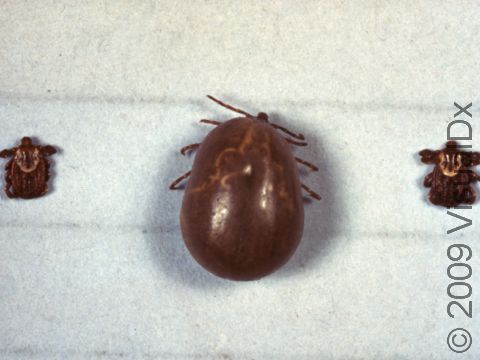 A tick that is filled with blood can grow quite a bit in size.